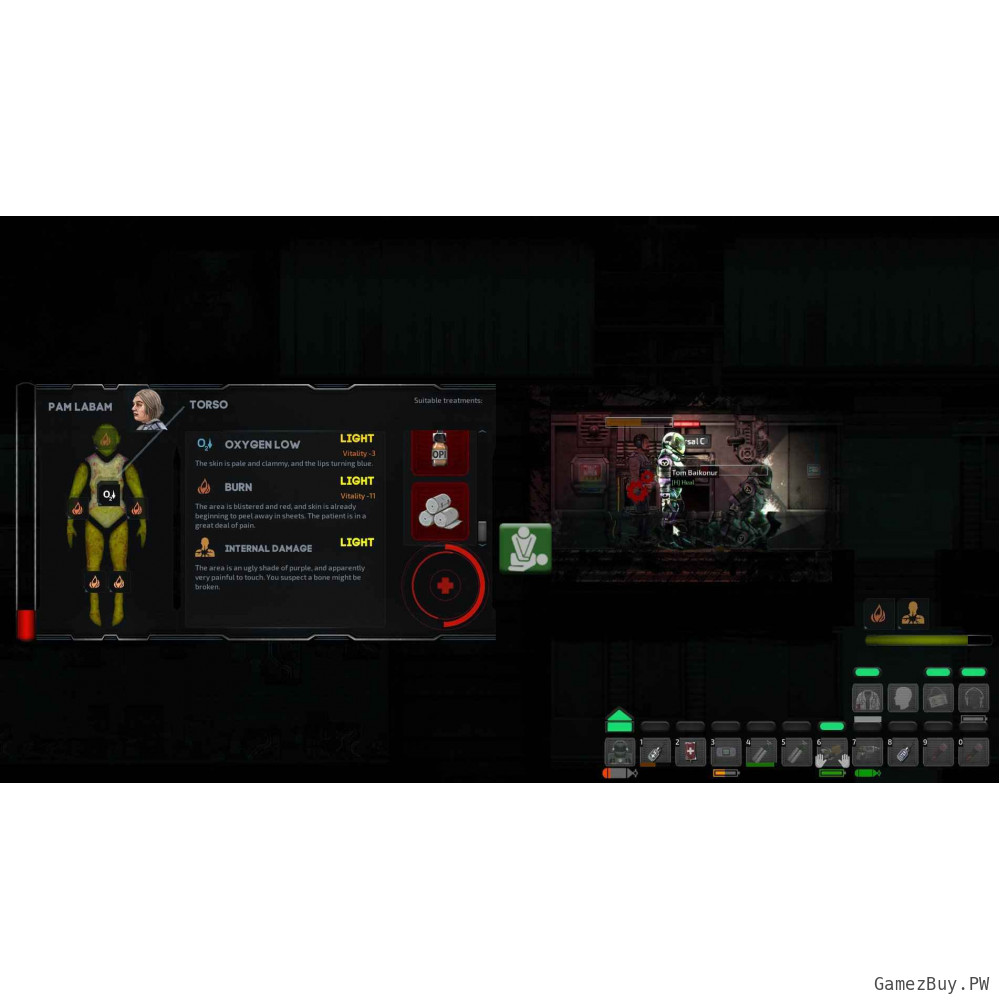Barotrauma